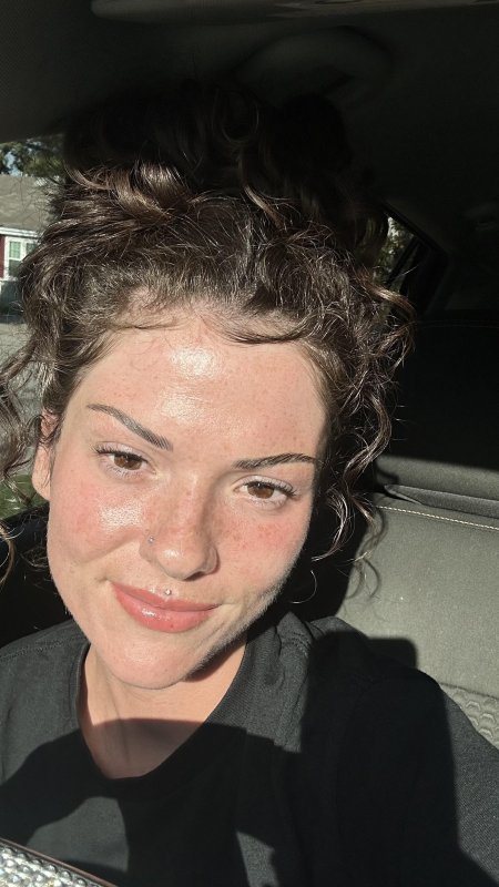 Up close look of the freckles the sun is BRIGHT